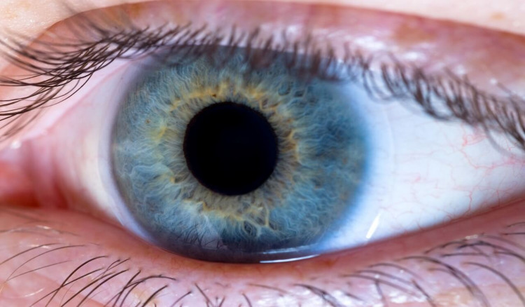 Macular Edema, Glaucoma and Cataracts